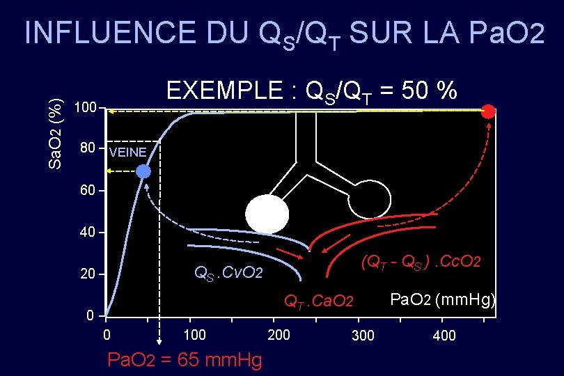 Sa. O 2 (%) INFLUENCE DU QS/QT SUR LA Pa. O 2 EXEMPLE :