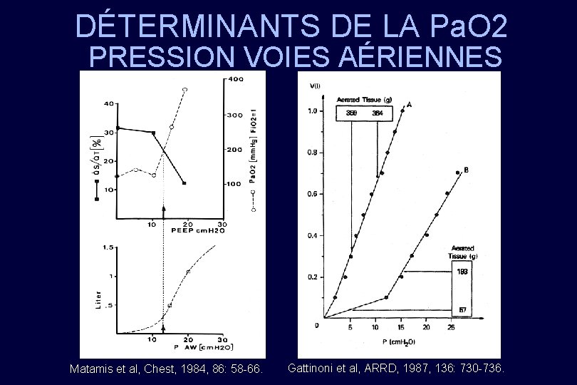 DÉTERMINANTS DE LA Pa. O 2 PRESSION VOIES AÉRIENNES Matamis et al, Chest, 1984,