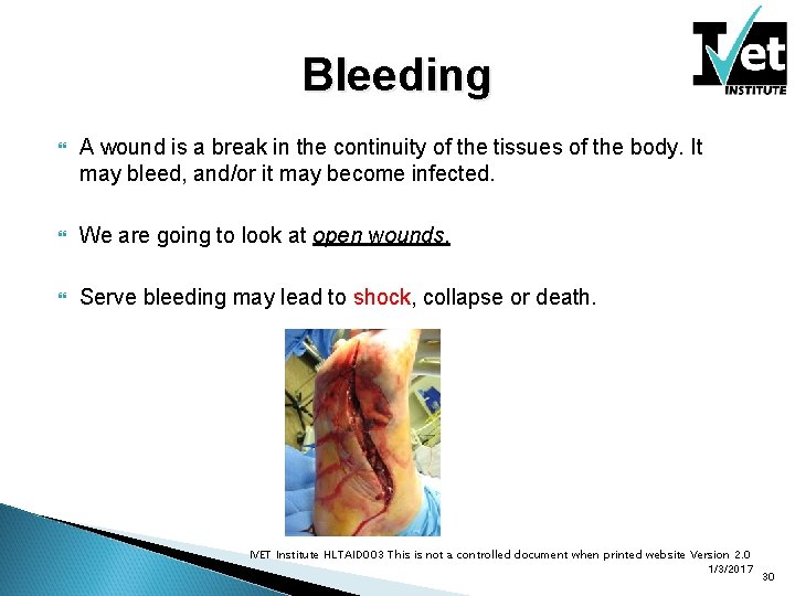 Bleeding A wound is a break in the continuity of the tissues of the