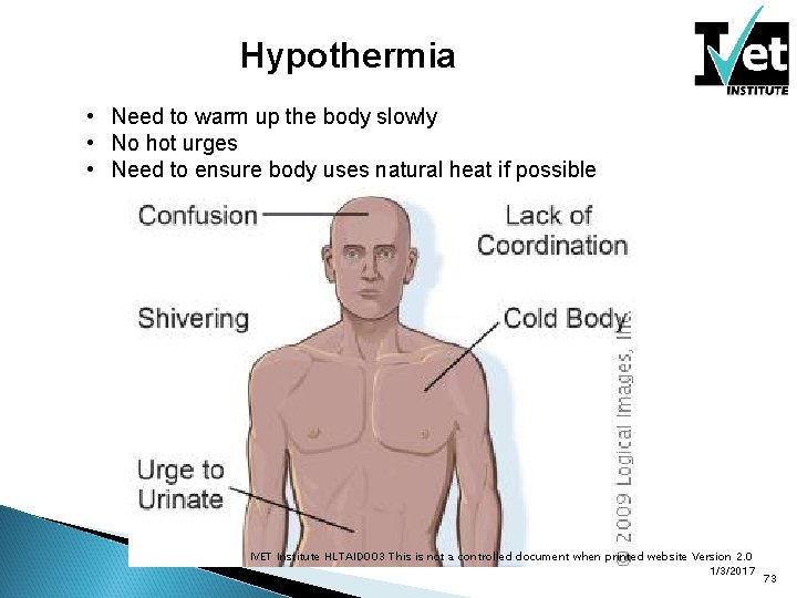 Hypothermia • Need to warm up the body slowly • No hot urges •