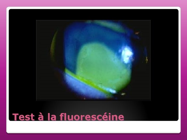 Test à la fluorescéine 