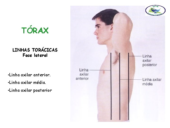 TÓRAX LINHAS TORÁCICAS Face lateral • Linha axilar anterior. • Linha axilar média. •