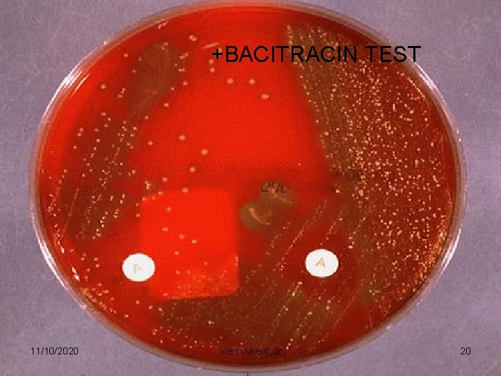 +BACITRACIN TEST 11/10/2020 alen vukelić, dr 20 