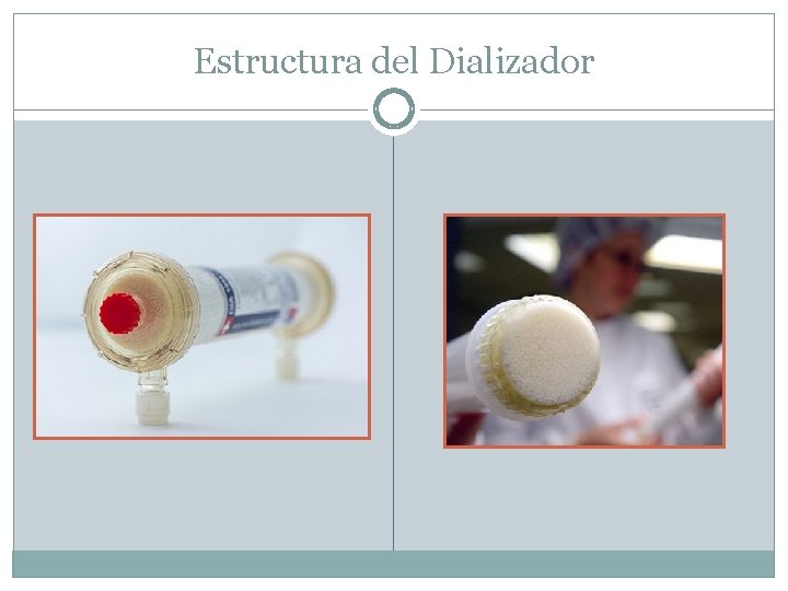 Estructura del Dializador 