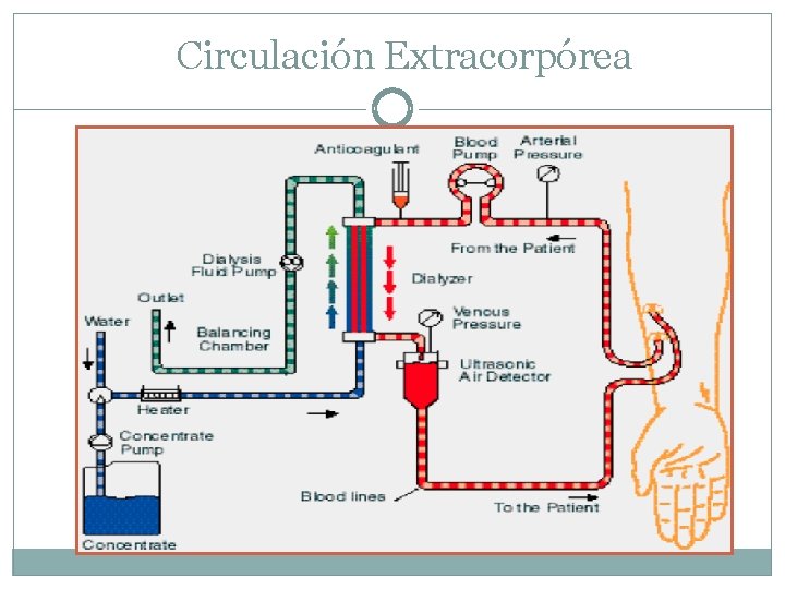 Circulación Extracorpórea 