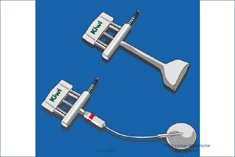 14 10 -11 -2020 VVOG cursus obstetrische vaardigheden 
