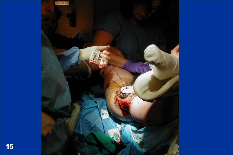 15 10 -11 -2020 VVOG cursus obstetrische vaardigheden 