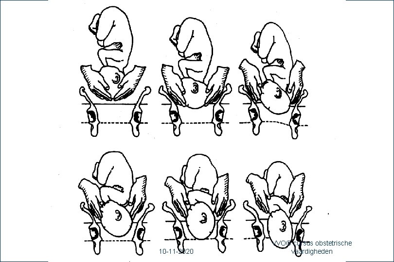 26 10 -11 -2020 VVOG cursus obstetrische vaardigheden 