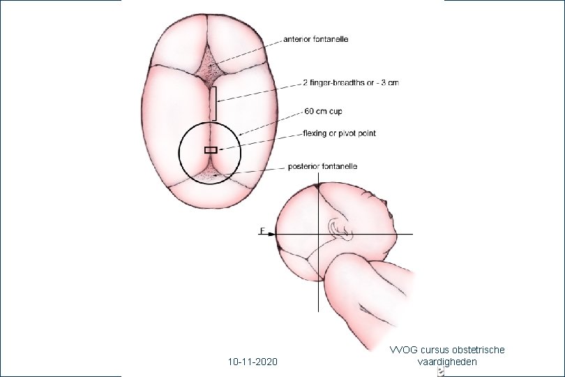 30 10 -11 -2020 VVOG cursus obstetrische vaardigheden 