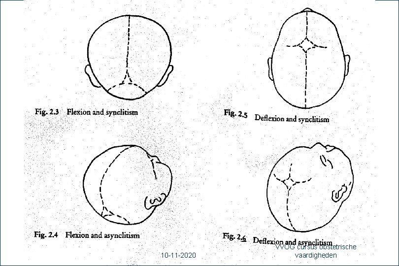 31 10 -11 -2020 VVOG cursus obstetrische vaardigheden 