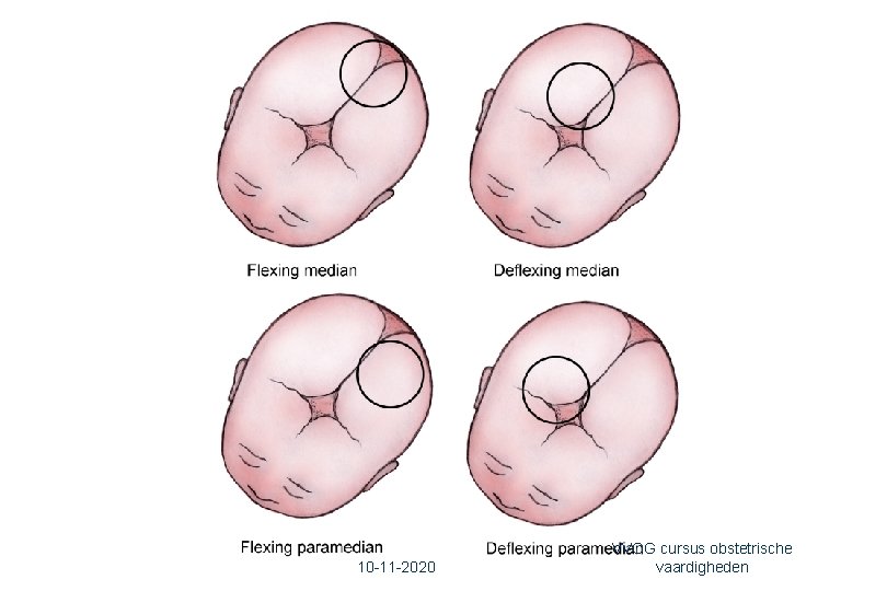 32 10 -11 -2020 VVOG cursus obstetrische vaardigheden 