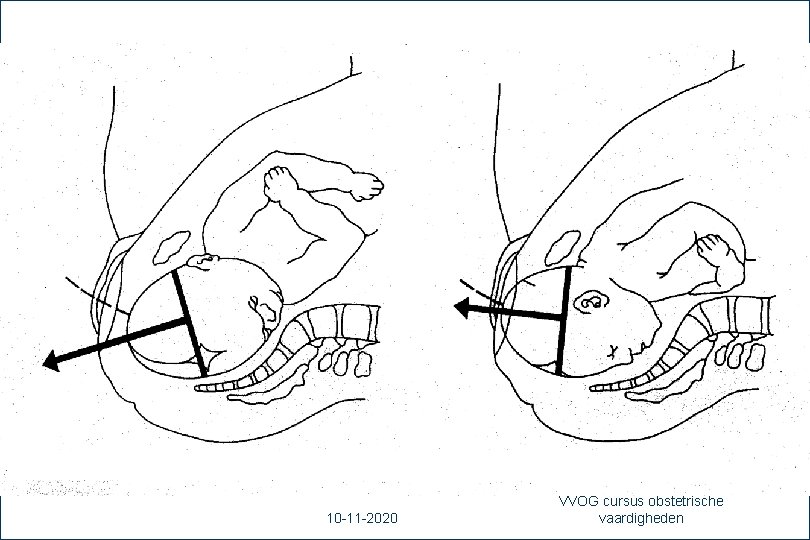 41 10 -11 -2020 VVOG cursus obstetrische vaardigheden 