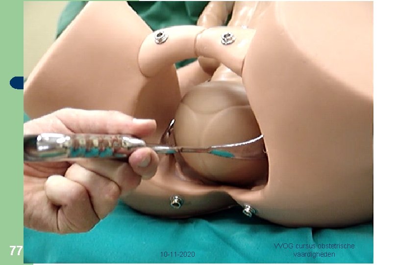 77 10 -11 -2020 VVOG cursus obstetrische vaardigheden 