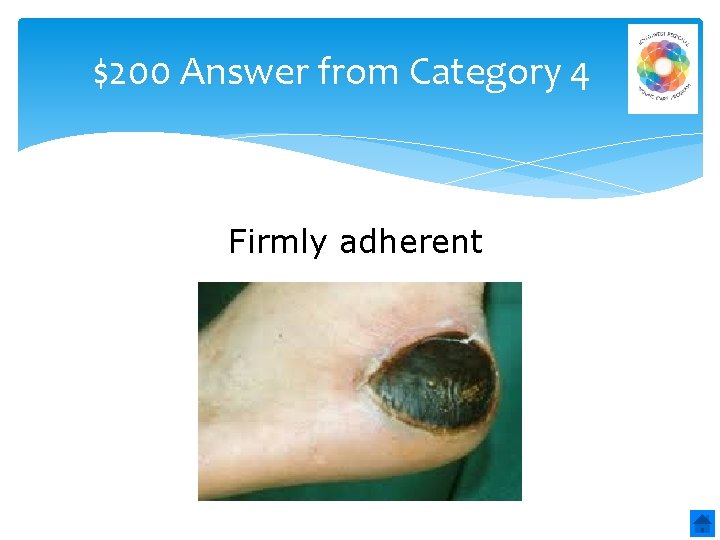 $200 Answer from Category 4 Firmly adherent 