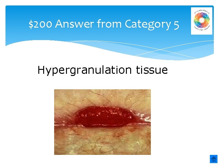 $200 Answer from Category 5 Hypergranulation tissue 