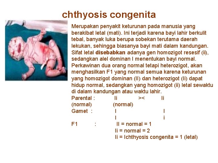 chthyosis congenita Merupakan penyakit keturunan pada manusia yang berakibat letal (mati). Ini terjadi karena