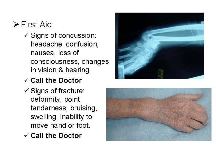 Ø First Aid ü Signs of concussion: headache, confusion, nausea, loss of consciousness, changes Ø First Aid ü Signs of concussion: headache, confusion, nausea, loss of consciousness, changes