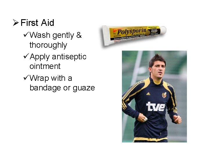 Ø First Aid üWash gently & thoroughly üApply antiseptic ointment üWrap with a bandage