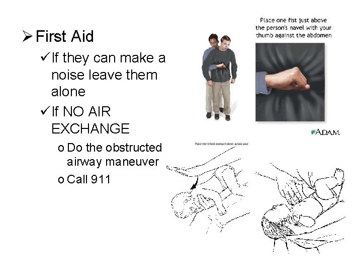 Ø First Aid üIf they can make a noise leave them alone üIf NO Ø First Aid üIf they can make a noise leave them alone üIf NO