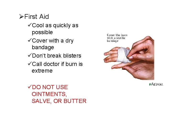 ØFirst Aid üCool as quickly as possible üCover with a dry bandage üDon’t break