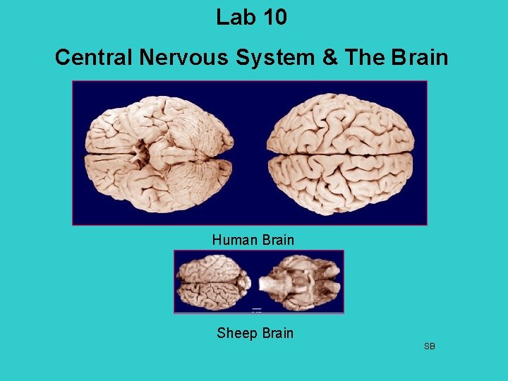 Lab 10 Central Nervous System & The Brain Human Brain Sheep Brain SB 