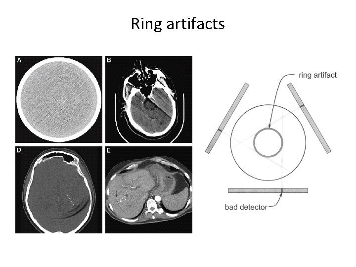 Ring artifacts 