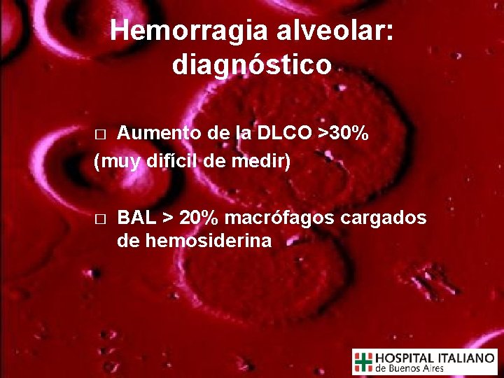 Hemorragia alveolar: diagnóstico Aumento de la DLCO >30% (muy difícil de medir) � �