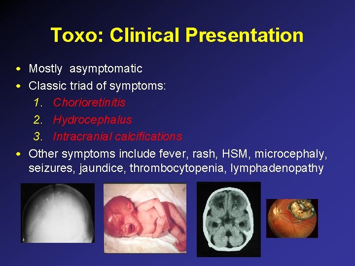 Toxo: Clinical Presentation • Mostly asymptomatic • Classic triad of symptoms: 1. Chorioretinitis 2. Toxo: Clinical Presentation • Mostly asymptomatic • Classic triad of symptoms: 1. Chorioretinitis 2.