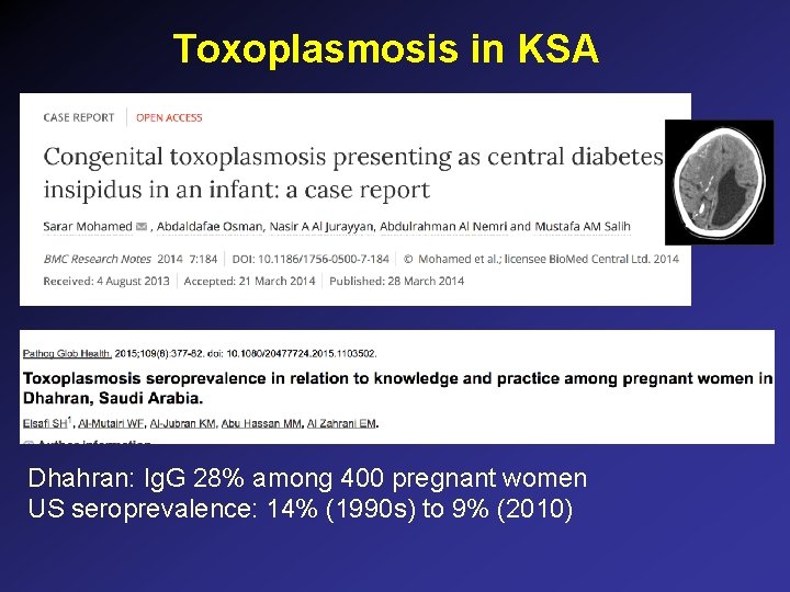 Toxoplasmosis in KSA Dhahran: Ig. G 28% among 400 pregnant women US seroprevalence: 14% Toxoplasmosis in KSA Dhahran: Ig. G 28% among 400 pregnant women US seroprevalence: 14%