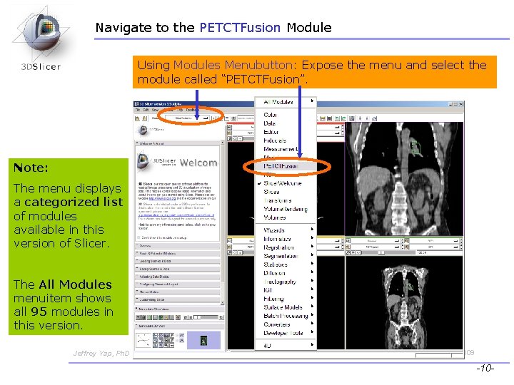 Navigate to the PETCTFusion Module Using Modules Menubutton: Expose the menu and select the