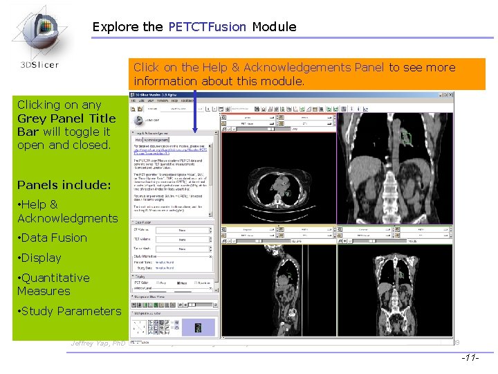 Explore the PETCTFusion Module Click on the Help & Acknowledgements Panel to see more