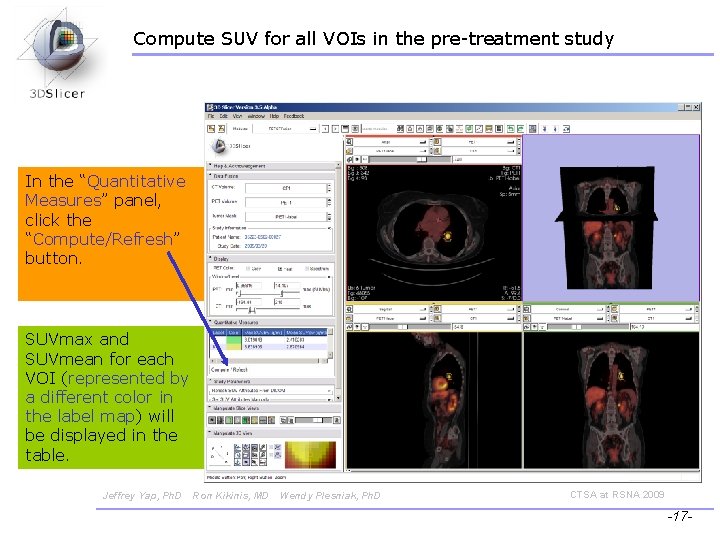 Compute SUV for all VOIs in the pre-treatment study In the “Quantitative Measures” panel,