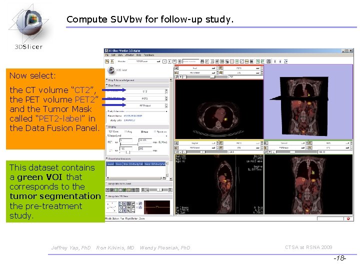 Compute SUVbw for follow-up study. Now select: the CT volume “CT 2”, the PET