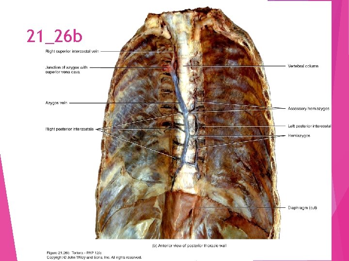 21_26 b 