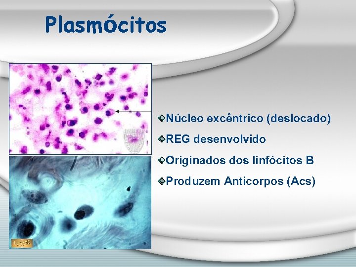 Plasmócitos Núcleo excêntrico (deslocado) REG desenvolvido Originados linfócitos B Produzem Anticorpos (Acs) 
