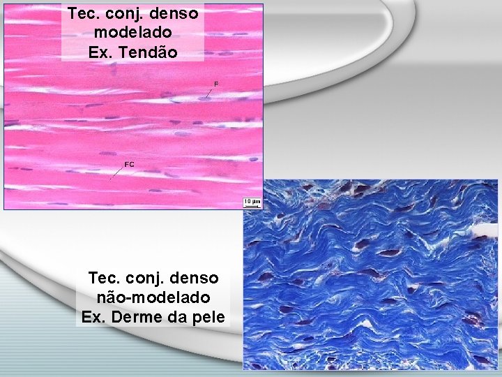 Tec. conj. denso modelado Ex. Tendão Tec. conj. denso não-modelado Ex. Derme da pele