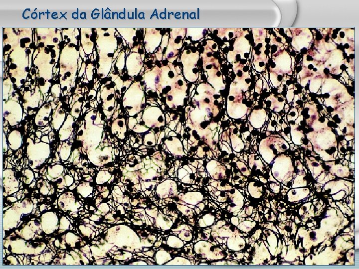 Córtex da Glândula Adrenal 
