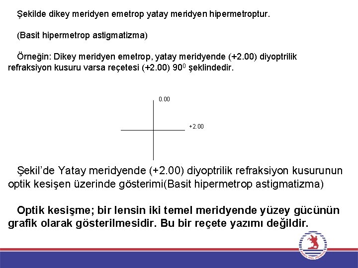 Şekilde dikey meridyen emetrop yatay meridyen hipermetroptur. (Basit hipermetrop astigmatizma) Örneğin: Dikey meridyen emetrop,
