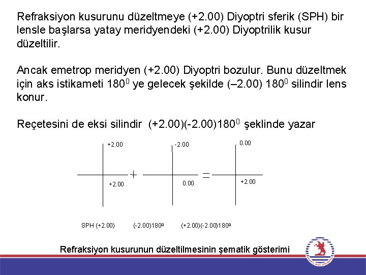 Refraksiyon kusurunu düzeltmeye (+2. 00) Diyoptri sferik (SPH) bir lensle başlarsa yatay meridyendeki (+2.