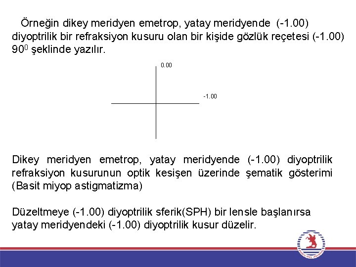 Örneğin dikey meridyen emetrop, yatay meridyende ( 1. 00) diyoptrilik bir refraksiyon kusuru olan