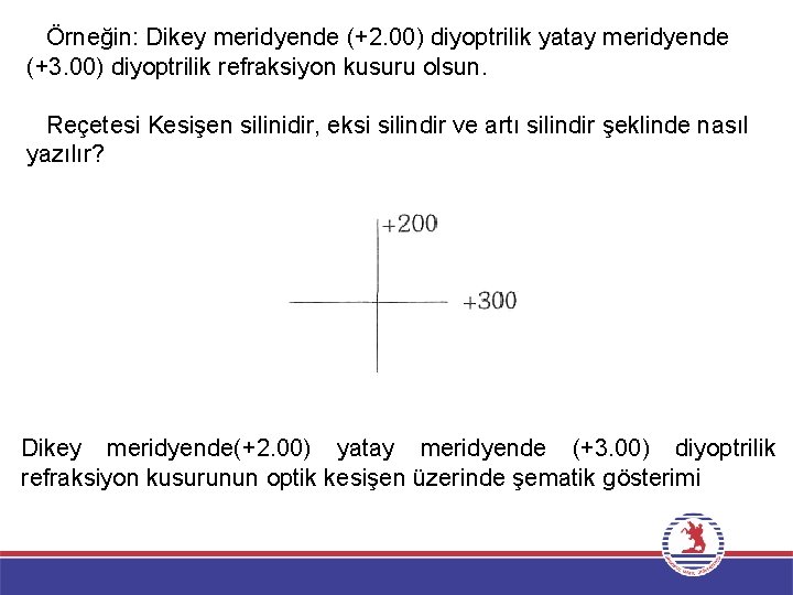 Örneğin: Dikey meridyende (+2. 00) diyoptrilik yatay meridyende (+3. 00) diyoptrilik refraksiyon kusuru olsun.