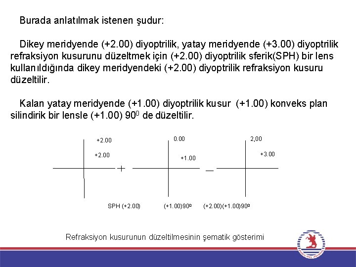 Burada anlatılmak istenen şudur: Dikey meridyende (+2. 00) diyoptrilik, yatay meridyende (+3. 00) diyoptrilik