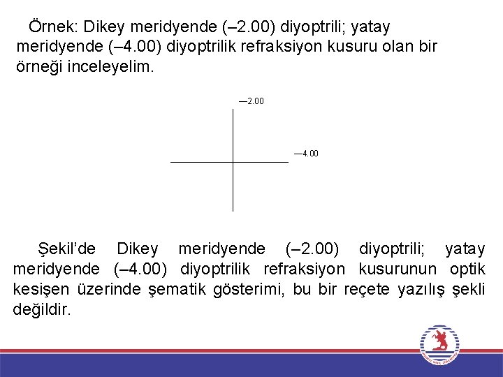 Örnek: Dikey meridyende (– 2. 00) diyoptrili; yatay meridyende (– 4. 00) diyoptrilik refraksiyon