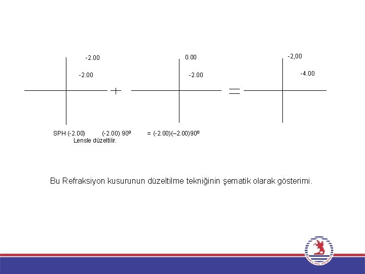  2. 00 SPH ( 2. 00) 90 0 Lensle düzeltilir. 0. 00 2.