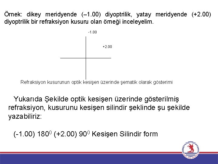 Örnek: dikey meridyende (– 1. 00) diyoptrilik, yatay meridyende (+2. 00) diyoptrilik bir refraksiyon