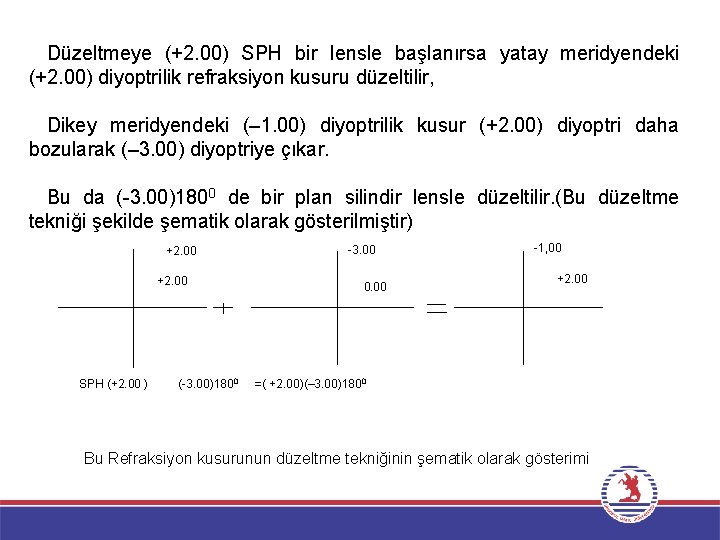 Düzeltmeye (+2. 00) SPH bir lensle başlanırsa yatay meridyendeki (+2. 00) diyoptrilik refraksiyon kusuru