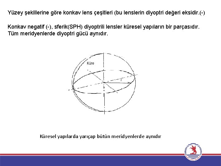 Yüzey şekillerine göre konkav lens çeşitleri (bu lenslerin diyoptri değeri eksidir. ( ) Konkav