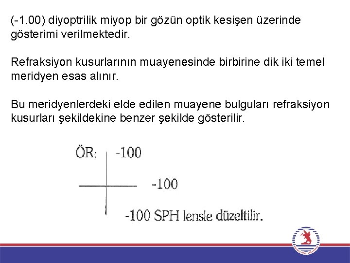 ( 1. 00) diyoptrilik miyop bir gözün optik kesişen üzerinde gösterimi verilmektedir. Refraksiyon kusurlarının