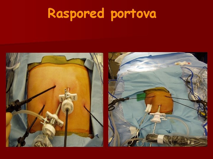 Raspored portova Raspored portova