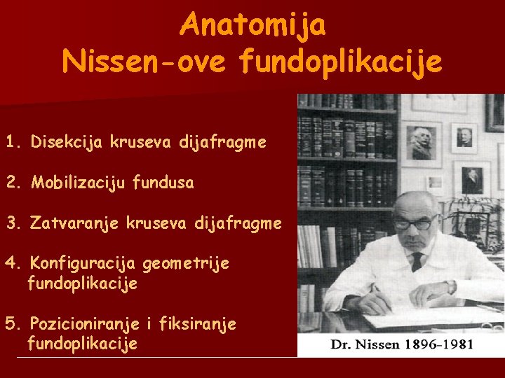 Anatomija Nissen-ove fundoplikacije 1. Disekcija kruseva dijafragme 2. Mobilizaciju fundusa 3. Zatvaranje kruseva dijafragme Anatomija Nissen-ove fundoplikacije 1. Disekcija kruseva dijafragme 2. Mobilizaciju fundusa 3. Zatvaranje kruseva dijafragme